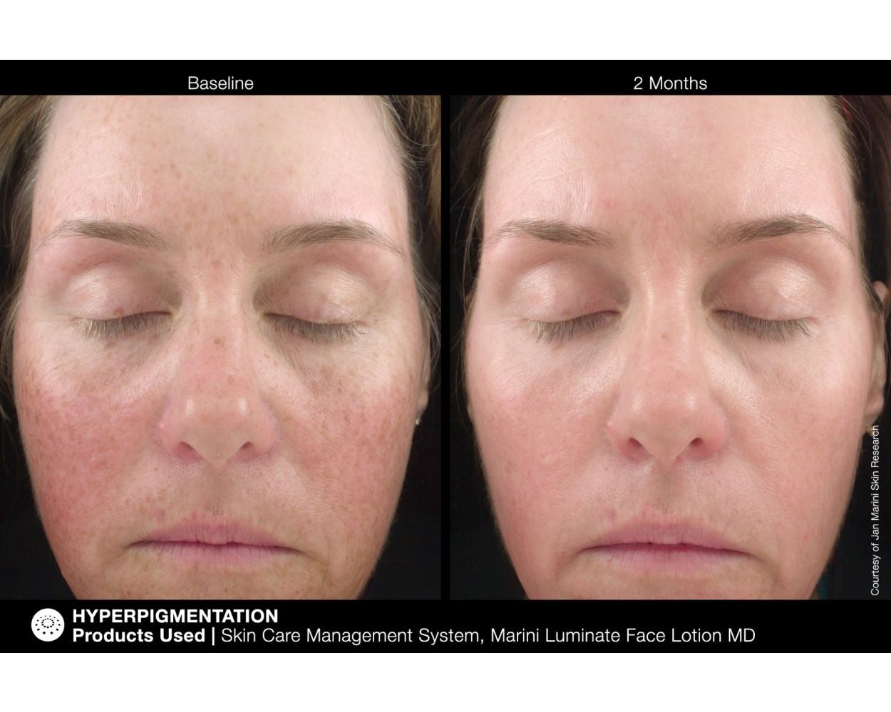 Jan Marini Luminate Face Lotion MD