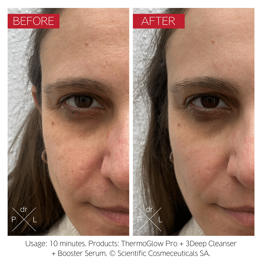 Dr Levy ThermoGlow Pro