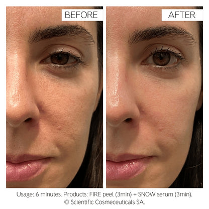 Dr Levy Fire & Snow Peel & Serum (20 Day Protocol 4x10ml)