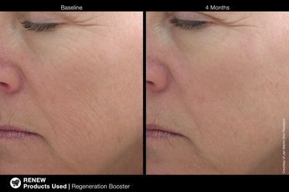 Jan Marini Regeneration Booster